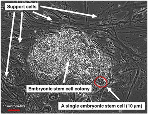 What Are Embryonic Stem Cells And How Can They Help Us · Frontiers For