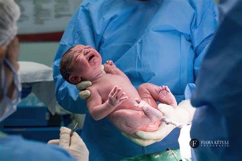 Bebê Nascendo Parto Normal Fotos