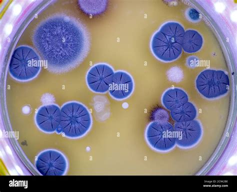 Fungal Colonies On Agar Plate Stock Photo Alamy