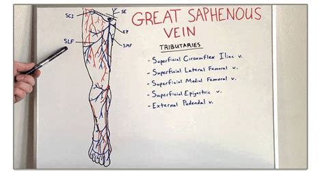 Bypass Surgery And The Great Saphenous Vein What To Do