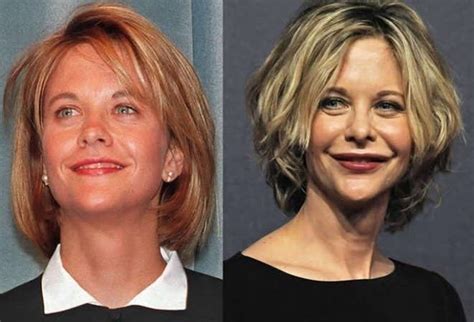 22 Most Shocking Celebrity Before And After Plastic Surgery Shots Celebrities Before And After