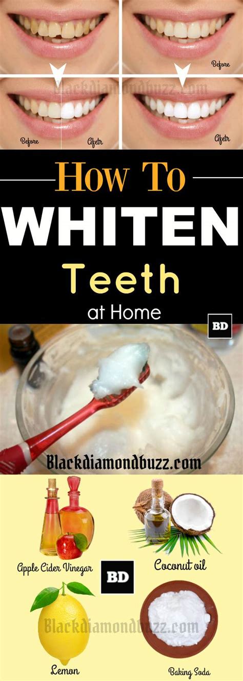 Home Remedies For Whiter Teeth Instantly Get Rid Of Yellow Teeth Fast