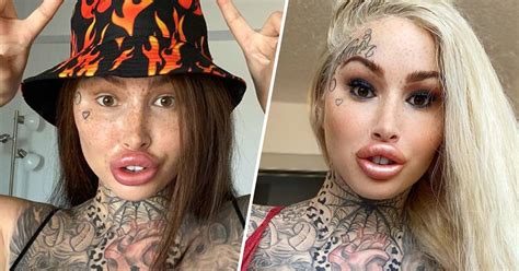 Model Mary Magdalene Cant Drink Through Straws Thanks To Multiple Surgeries