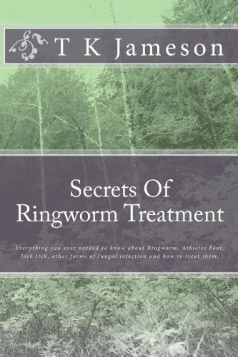 Secrets Of Ringworm Treatment Everything You Ever Needed To Know About