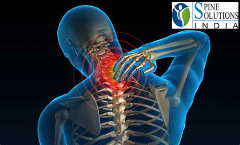 Spine Solutions India By Dr Sudeep Jain Prevent Common Neck Pain