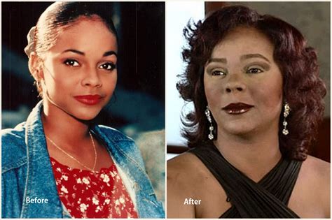 Top 10 Worst Celebrity Plastic Surgery Disasters From