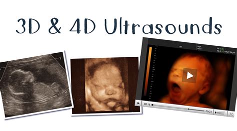 4d Ultrasound Lowcountry Womens Specialists