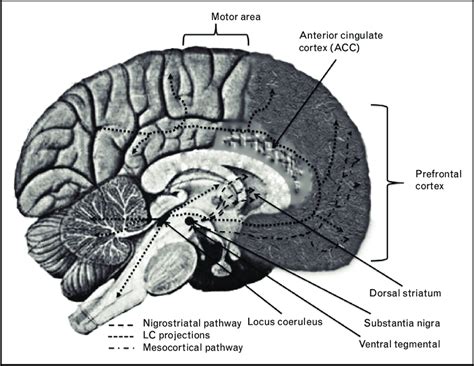 Shahidi ga, rohani m, parvaresh m. An overview of brain regions implicated in MCI, Parkinson's disease,... | Download Scientific ...