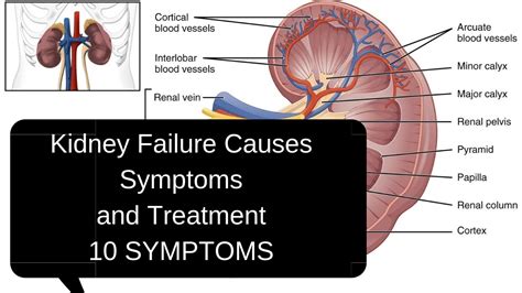 Kidney Failure Causes Symptoms And Treatment 10 Symptoms Sam Youtube