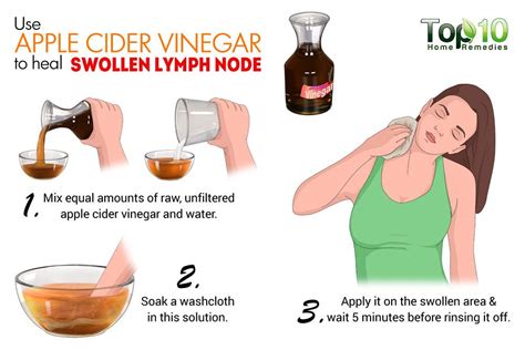 How To Treat Swollen Lymph Nodes In Neck Naturally Drdougcrosby Com