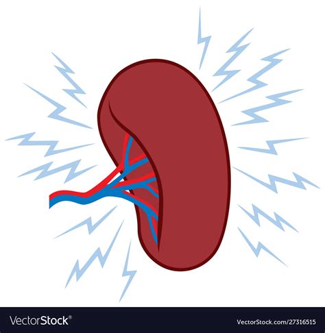 Problem With Human Spleen Royalty Free Vector Image