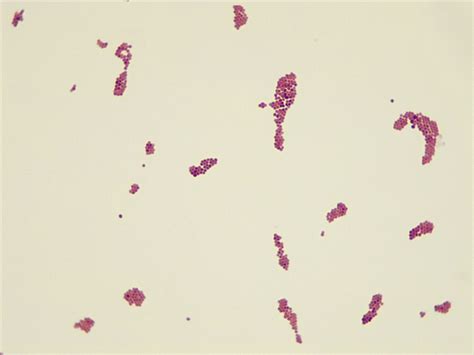 Micrograph Neisseria Sicca Gram Stain 1000x P000030 OER Commons