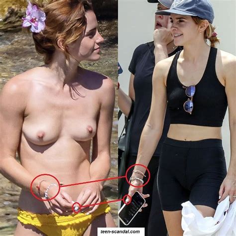 Emma Watson Has Been Caught Topless In Ibiza Uploader9