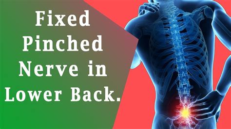 Pinched Nerve In Lower Back How To Fixed Pinched Nerve In Lower Back