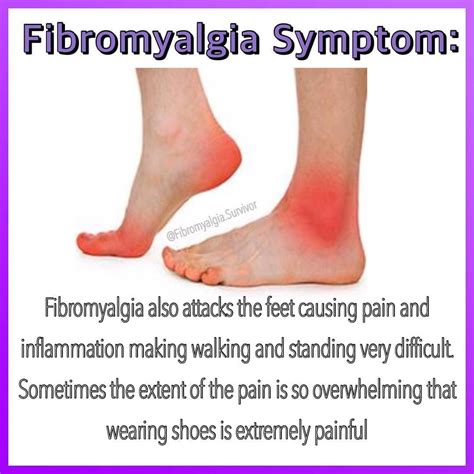 My Feet Are Super Sensitive Any Other Fibro Warriors Deal With This