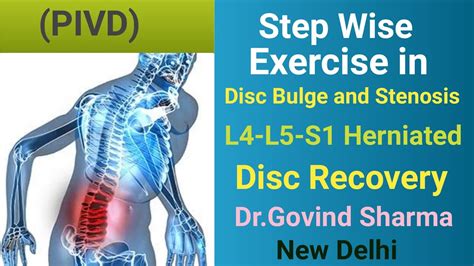 Exercise For Herniated Disc Bulge L L S Step Wise Treatment