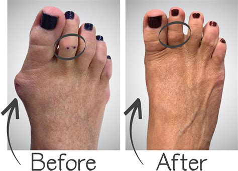 Feet For Life Podiatry Foot Doctor In St Louis And Chesterfield Mo