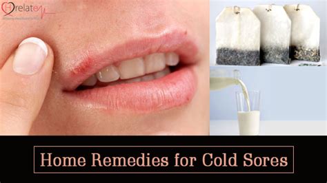 Aphthous stomatitis, also commonly known as canker sores are tiny red bumps that appear inside the mouth, on the lips, the inner cheeks, inside the throat and on the tongue. Home Remedies for Cold Sores: Fever Blister Se Nijad Paye