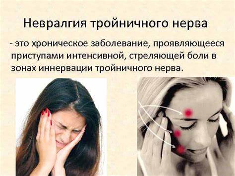 Диета при невралгии тройничного нерва Как лечить неврит тройничного нерва: Невралгия тройничного нерва Как лечить неврит тройничного нерва: Невралгия тройничного нерва Диета при невралгии тройничного нерва