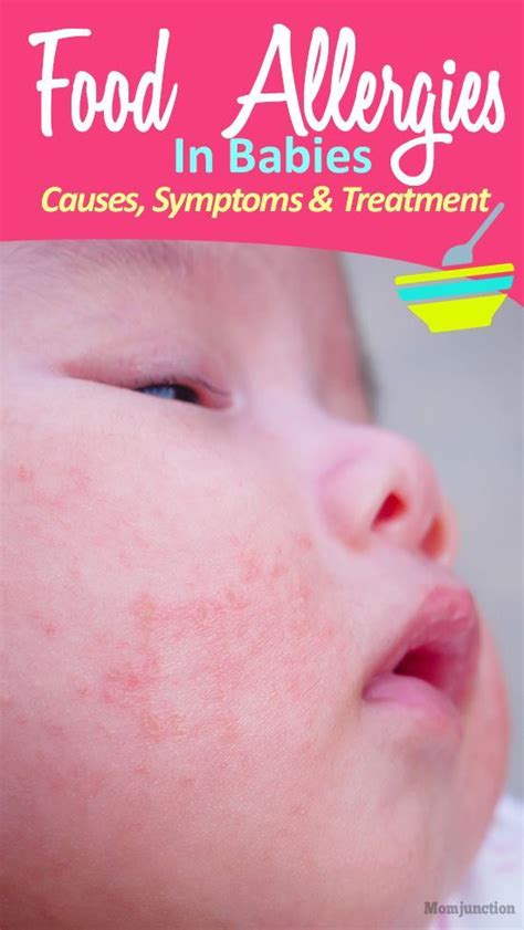 Identifying Food Allergies In Babies Dixon Verse