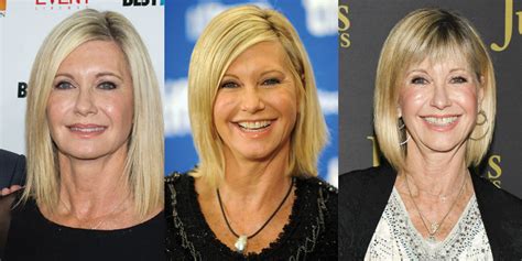 Olivia Newton John Plastic Surgery Before And After Pictures 2020