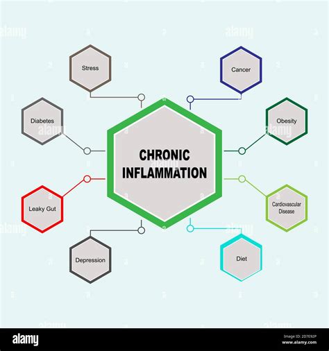 Diagram Of Chronic Inflammation With Keywords Eps 10 Stock Vector