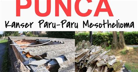 Paru paru berair / kronis. Hidup Matiku: Bumbung Asbestos Punca Kanser Paru-Paru