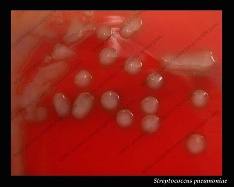 Streptococcus Pyogenes Morphology