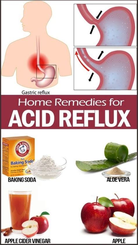 Some Useful Remedies For You To Cut Down On Acid Reflux