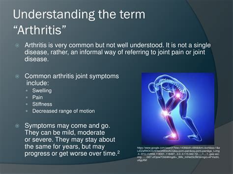 Ppt C27 Rheumatoid Arthritis Powerpoint Presentation Free Download