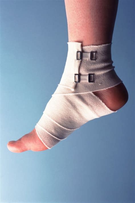How To Care For A Sprained Foot