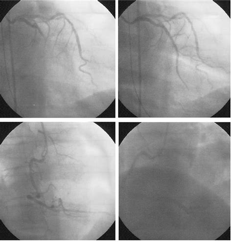 Cardiol Res