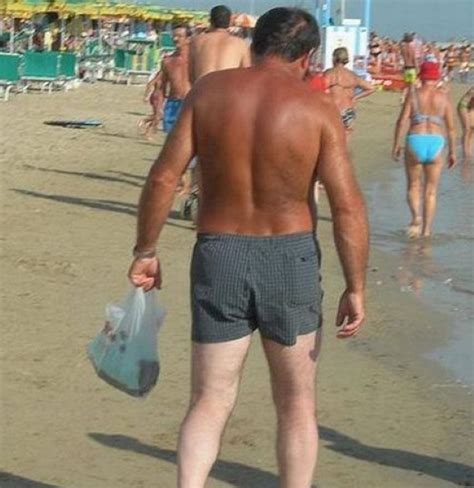 People Living With The World S Most Awkward Sun Tan Line Fails Ever