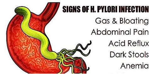 Helicobacter Pylori H Pylori Infection Causes Symptom Natural