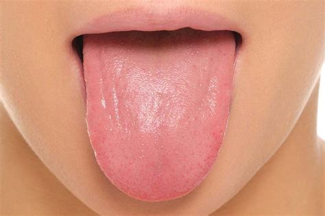 15 Common Tongue Diseases That Can Affect You