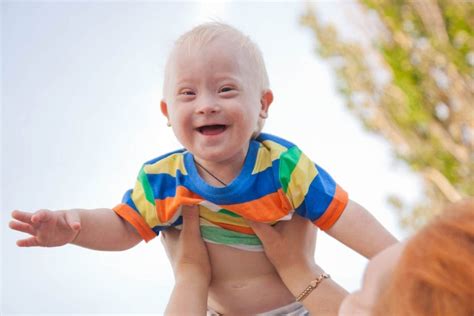 Cuidados De Salud Para Bebés Con Síndrome De Down