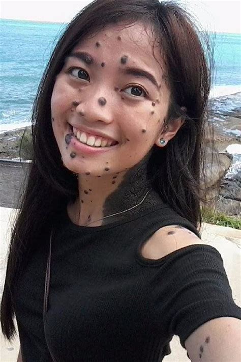 How 1 Woman Learned To Embrace Her Body Covered In Moles Pretty People Bare Beauty Women