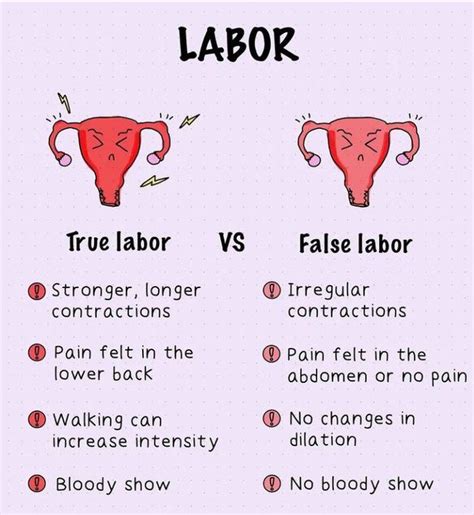 True Labour Vs False Labour Medizzy