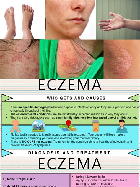Understanding Eczema Causes Symptoms Diagnosis And Treatment Options Pdf Dermatitis Rtt