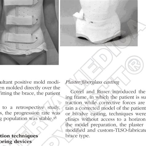 Pdf Bracing For Scoliosis In 2014 State Of The Art