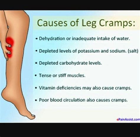 What Causes Leg Cramps In Ckd Patients Ash In The Wild