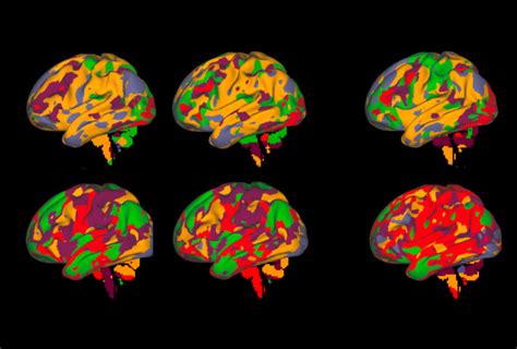 Brain Scans From One Person Build Reliable Map Of Brain Activity