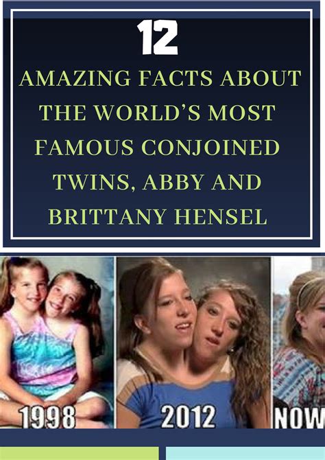 12 Amazing Facts About The Worlds Most Famous Conjoined Twins Abby