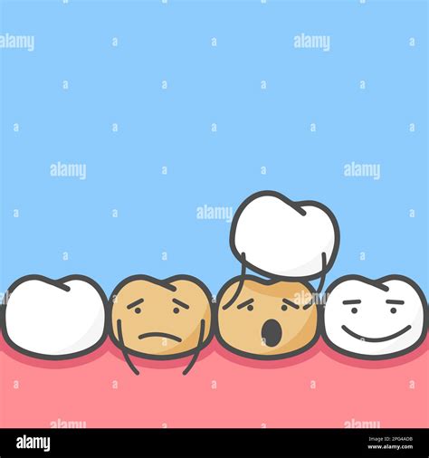 Smile makeover, dental ceramic veneers, row of cute cartoon teeth