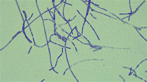 Is This Filamentous Rods More Details In Comments Rmicrobiology