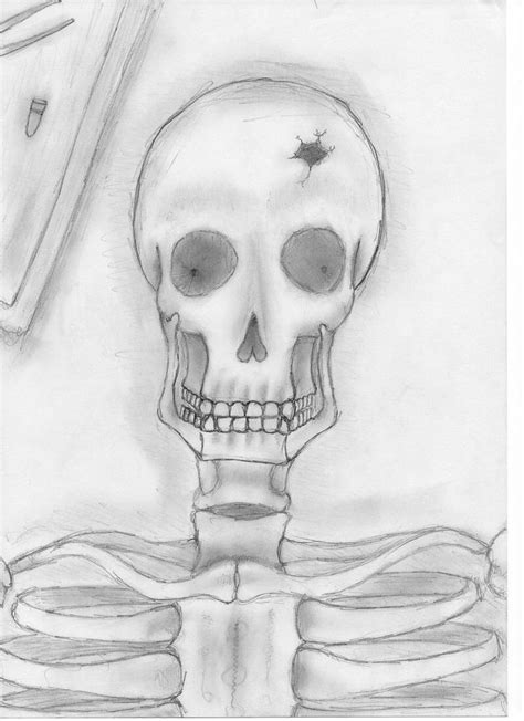 Skeleton Autopsy By Spidermanic On Deviantart