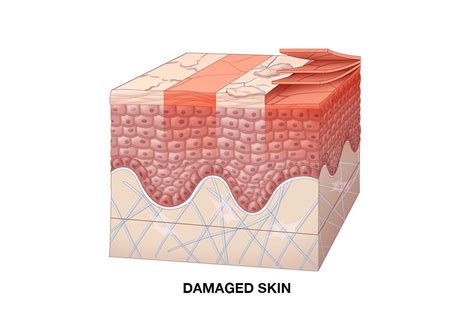 How To Repair A Damaged Skin Barrier Function Kiehls Uk