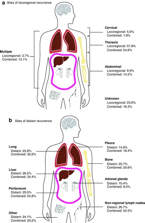 Sites Of Recurrence A Sites Of Locoregional Recurrence In Patients With
