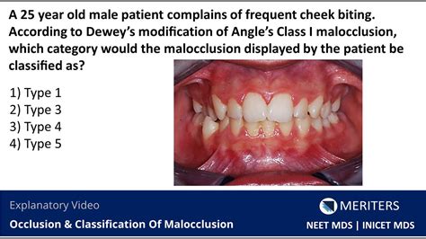 Neet Mds Inicet Occlusion And Classification Of Malocclusion