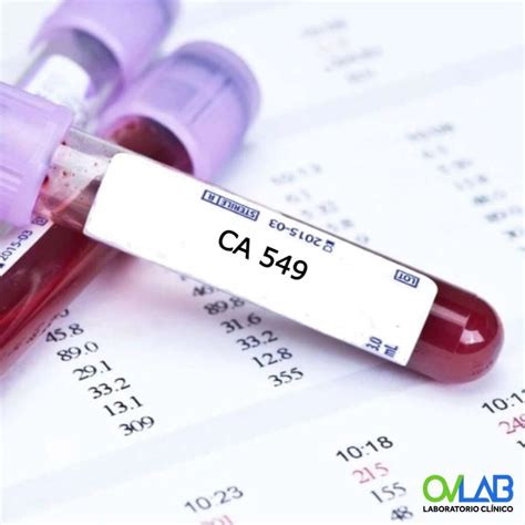 Cea - Antígeno Carcinoembriônico